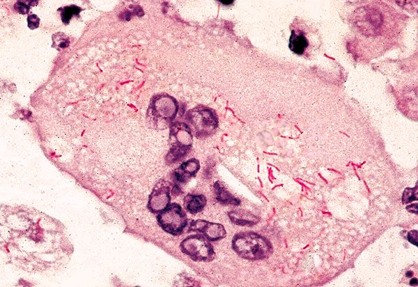 Bacteria febrei Marsilia