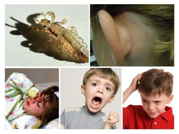 Why lice are dangerous for children