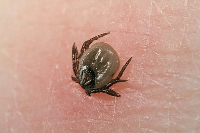 What to do if the tick head remains in the human body
