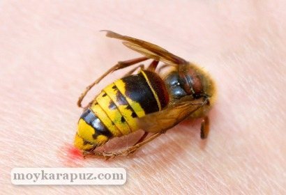 What to do if your child is bitten by a bee or wasp?