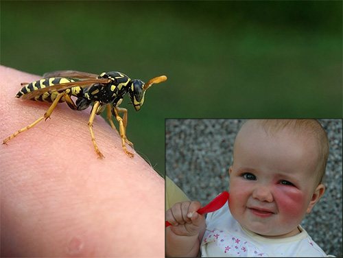 Let's talk about what the parents should do if the child is bitten by a wasp, and see what should be done in such a situation first ...