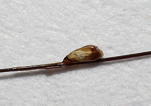 Walaupun larva kutu meninggalkan nits, cengkerang terus tergantung pada rambut (nits kering)