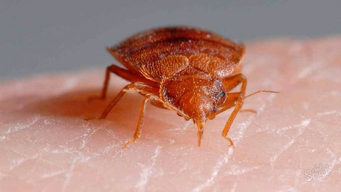 Photo: what a bug bite looks like on a human body, symptoms