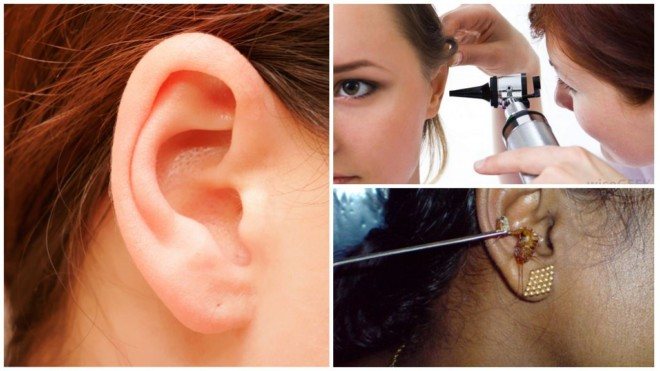 Odstranění švába z ucha