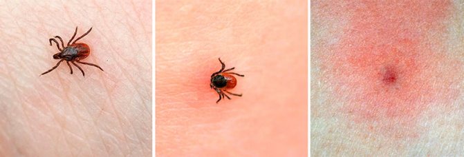 How to distinguish an encephalitis tick from a common one 6