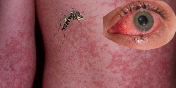 Hur ser en anopheles-mygga ut och vad är farligt?