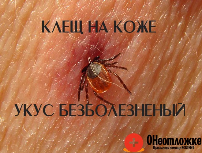 mite on the skin