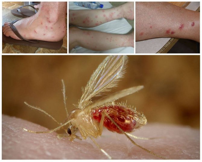 Huraian nyamuk berkaki panjang, foto. Adakah karamora berbahaya bagi manusia