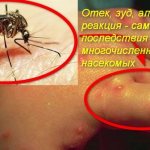 urme de țânțari și mușcături pe braț