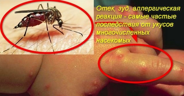 Mücken- und Bissspuren am Arm