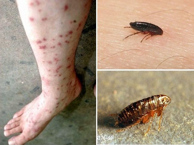 Cat fleas: why are they dangerous, do they bite people, how to get rid of them in the house