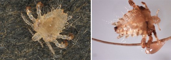pubic lice and nit photos