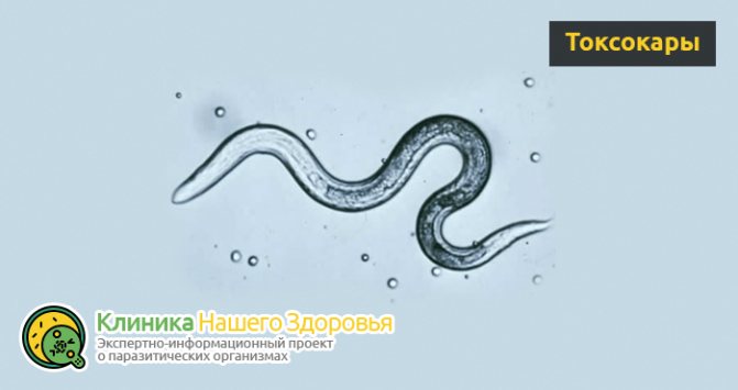 Малки бели червеи при хората: видове и особености