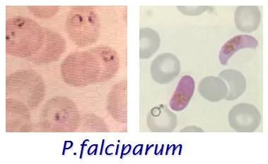 Malaria plasmodium