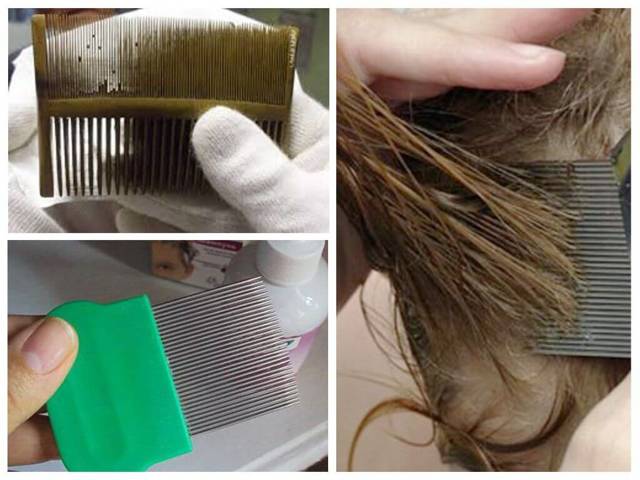 Nyuda - a remedy for lice and nits: reviews, instructions for use