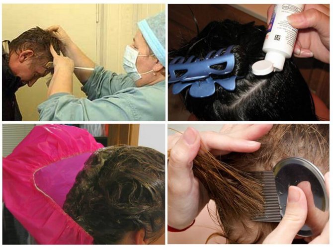 Hair treatment for head lice