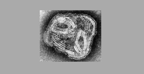 Paramyxovirus způsobující newcastleskou chorobu
