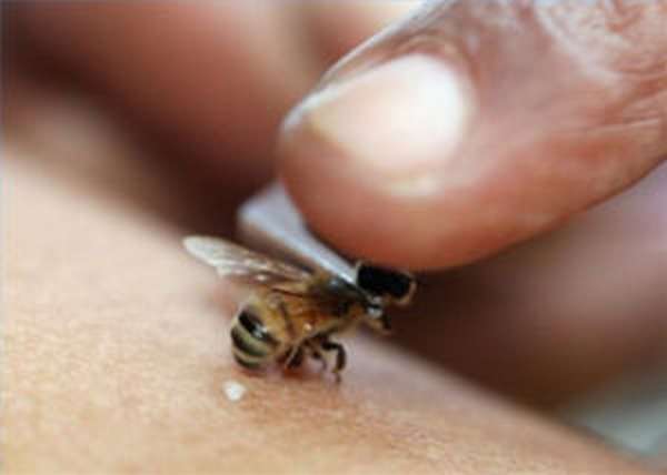 سم النحل: فوائده وأضراره ، وماذا تفعل مع لدغة النحل في المنزل