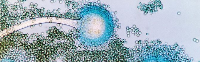 mold under the microscope