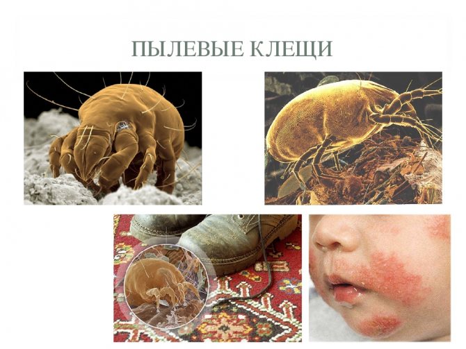 Прахови акари: снимка на паразита, признаци на алергични реакции и тяхното лечение