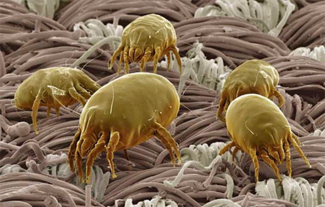 Ang mga dust mite na larawan sa ilalim ng isang mikroskopyo