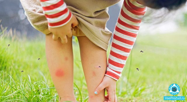 Kind gekämmte Mückenstiche