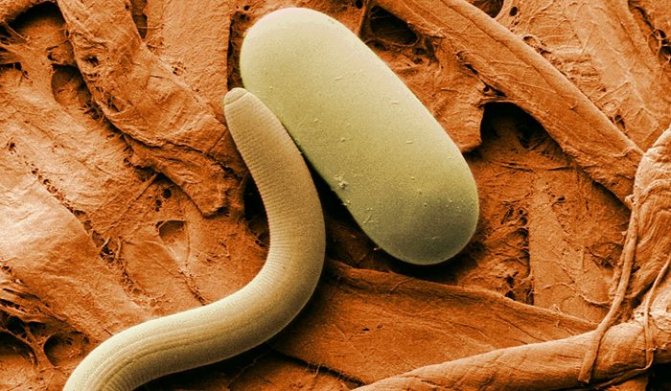 Mga pagkakaiba-iba ng saprophytes at parasites