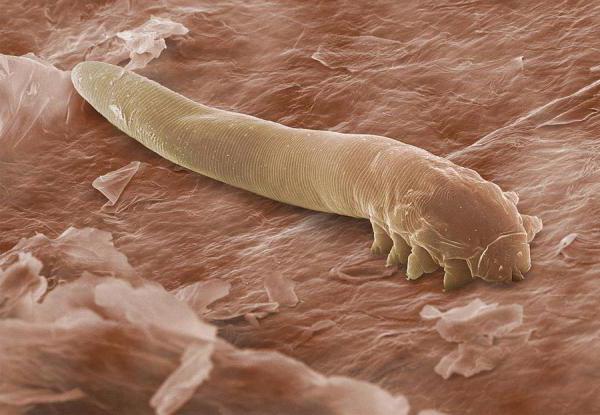 how many ticks live without a proboscis