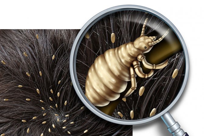 How many lice live outside a person's head: can nits live in pillows, how many days do they go without people