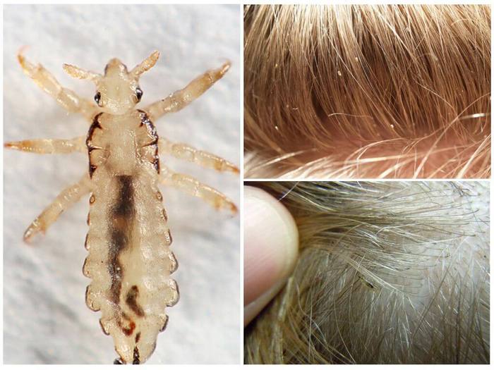 how many lice live outside the head