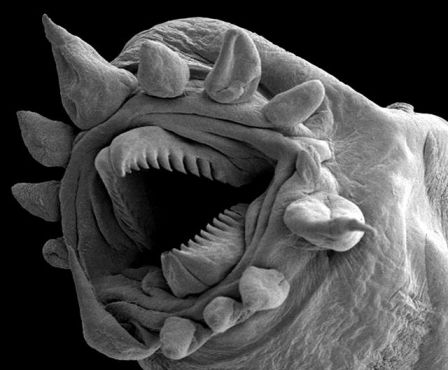 Mukhang isang tik na nakunan ng larawan gamit ang isang mikroskopyo