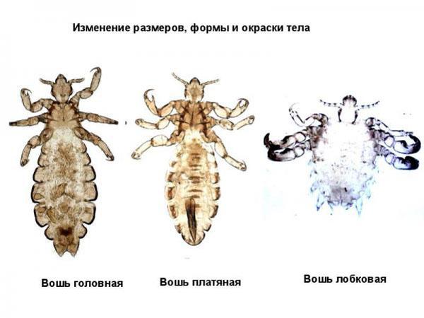 Three types of human lice