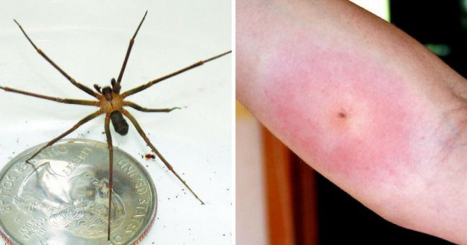 Hermit Spider Bite på huden