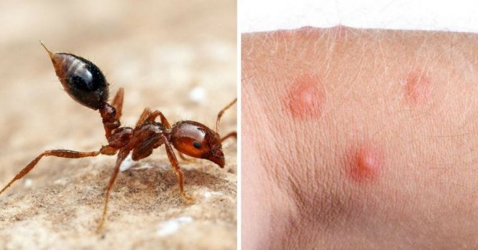 Ingefära myra bett på huden