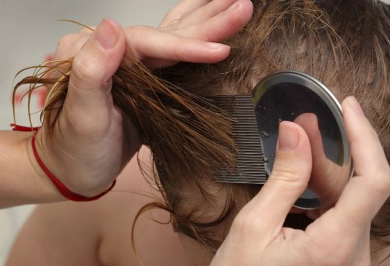Как да се отървете от въшки в косата си
