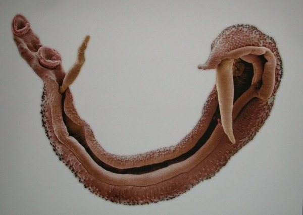 Schistosomul adultului