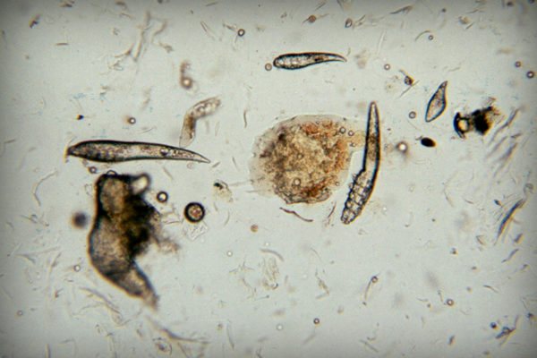 Ägg, larver och kvalster i linsen i ett mikroskop