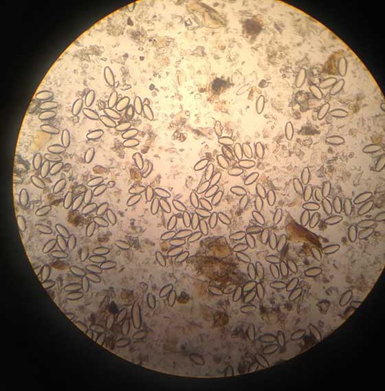 Pinworm ägg under ett mikroskop