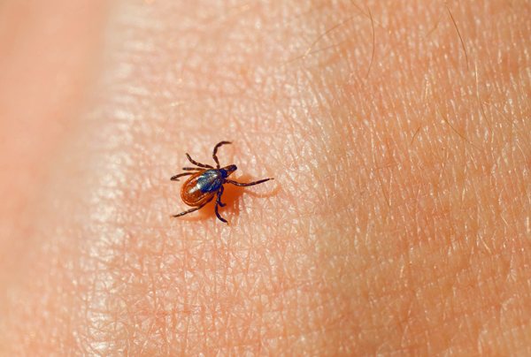 Infection with tick-borne encephalitis occurs through the bite of the parasite, and with simple contact with the skin, the virus is not transmitted.